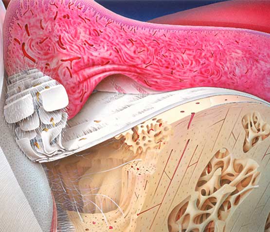 Periodontal Bone Loss | Peace Periodontics